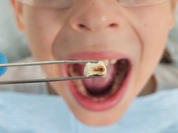 Best Pediatric Emergency Dentist in Gilcrest, CO